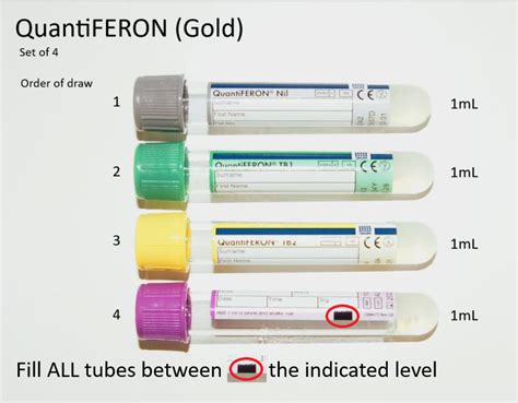 quantiferon blood test bottle|quantiferon tb gold fact sheet.